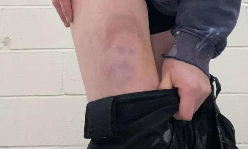 Le prince Harry apparait sur la jambe d'un footballeur 